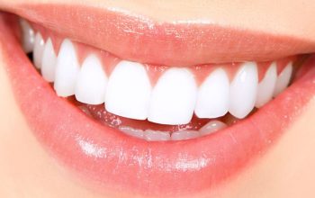 Ilustrasi gigi yang rapi dan terawat. Pict by Pinterest