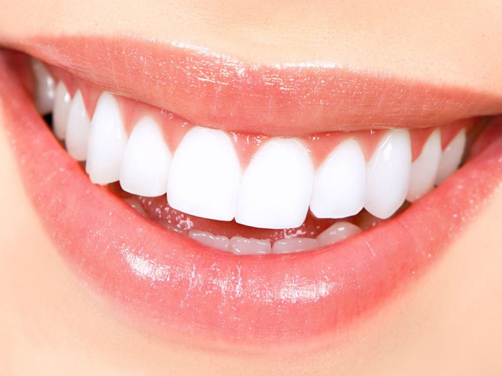 Ilustrasi gigi yang rapi dan terawat. Pict by Pinterest
